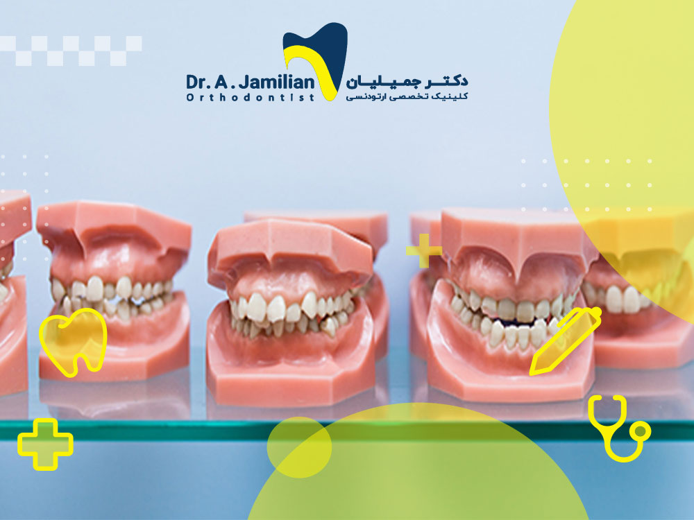 Know dental abnormalities: types and treatments - Dr. Jamilian
