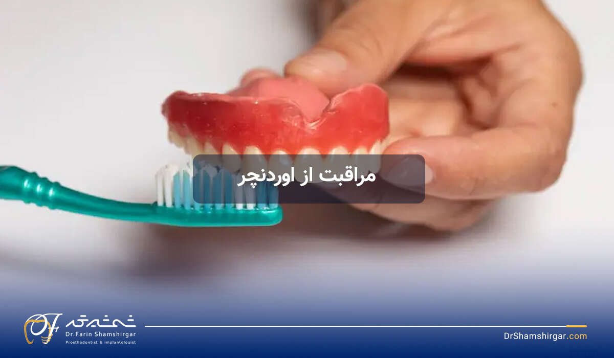 Overdenture Care - How do I take care of overdenture implants?