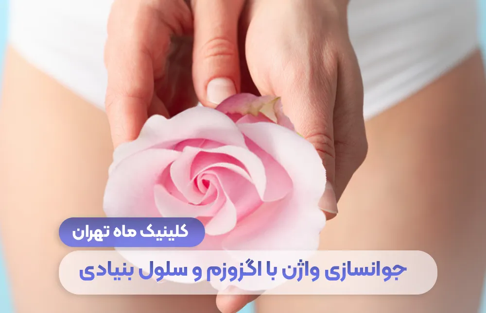 تجديد المهبل بالاكسوسوم والخلايا الجذعية + تكلفته - عيادة ماه، طهران