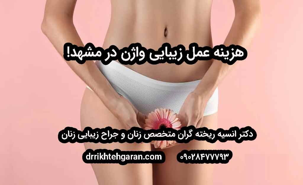 هزینه جراحی زیبایی واژن در مشهد – راهنمای کامل
