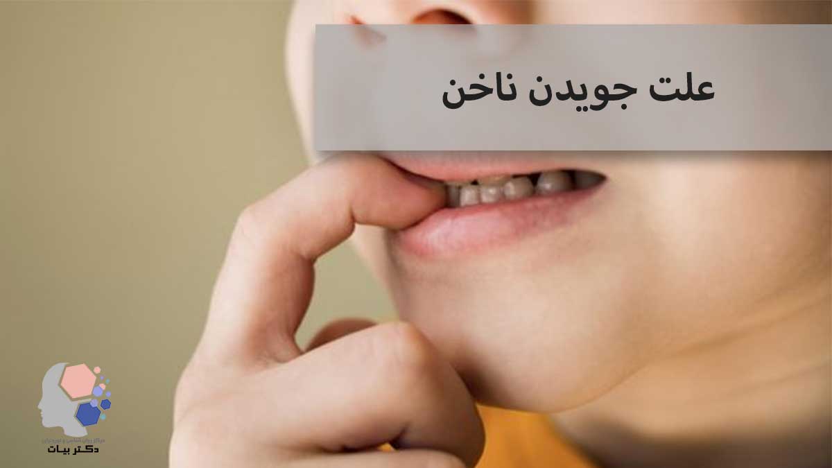 علت جویدن ناخن؛ تحلیل روانشناختی رفتار در بزرگسالان و نوجوانان - مرکز روانشناسی و نوروفیدبک دکتر بیات