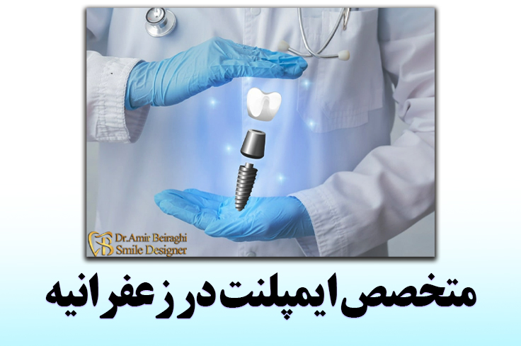 متخصص ایمپلنت در زعفرانیه هزینه درمان + تجهیزات