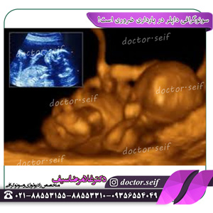 الموجات فوق الصوتية دوبلر ضرورية أثناء الحمل!