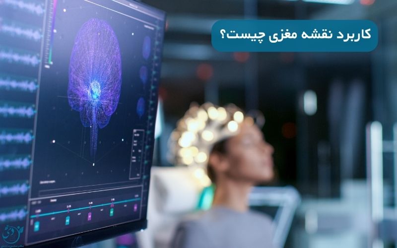 کاربرد نقشه مغز راهکاری جدید برای افزایش خلاقیت و بهبود حافظه - کلینیک روانشناسی بالینی دی.