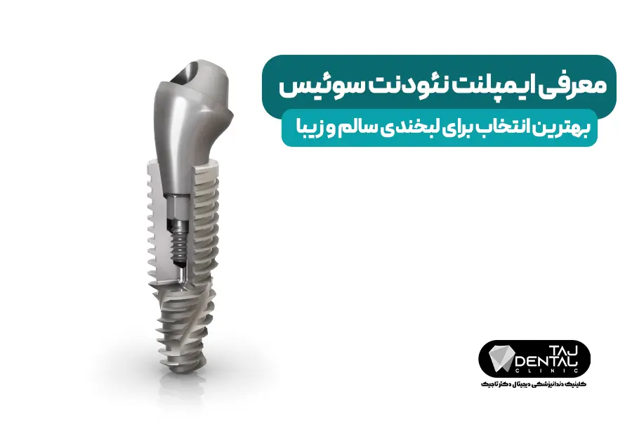 Introducing Swiss Neodent Implant: the best choice for a healthy and beautiful smile