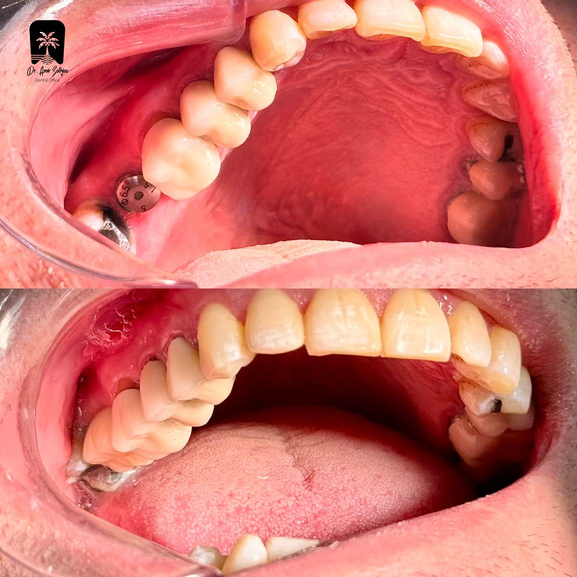 کاشت فرش بی صدا جدول هزینه + شرایط اقساط