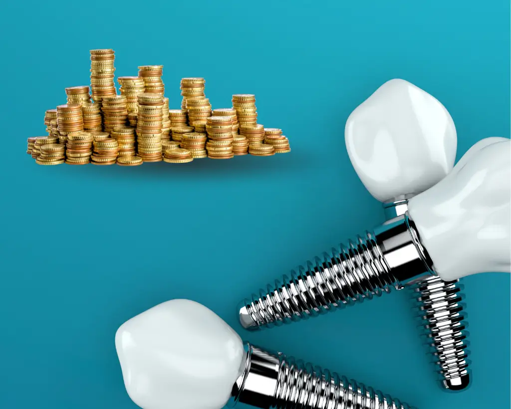 قیمت ایمپلنت دندان در سنندج دکتر سجاد ظفری