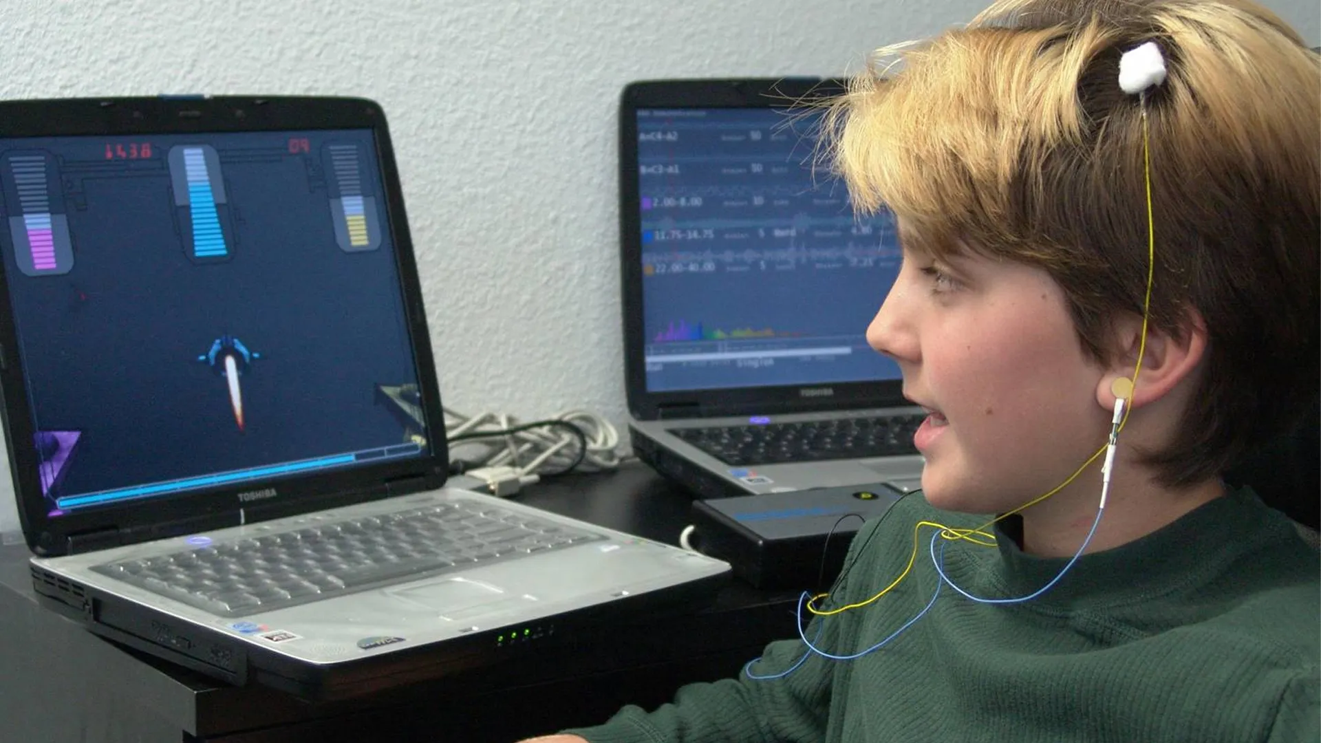 All about neurotherapy for hyperactivity: from cost to results