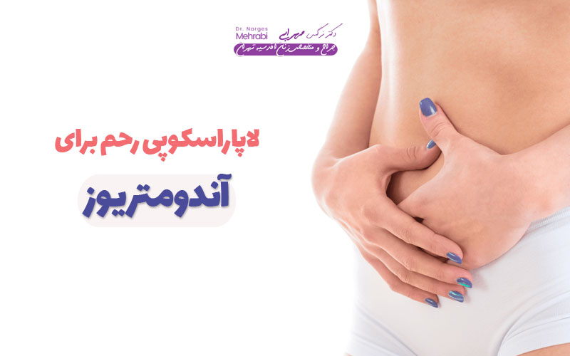 لاپاراسکوپی رحم برای اندومتریوز دکتر نرگس محرابی