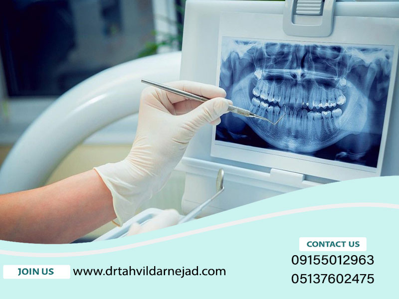 When should we take a dental OPG photo? |Dr. Tardishdarnjad