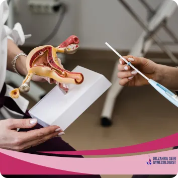 Types of labiaplasty surgery methods + 3 terms related to it