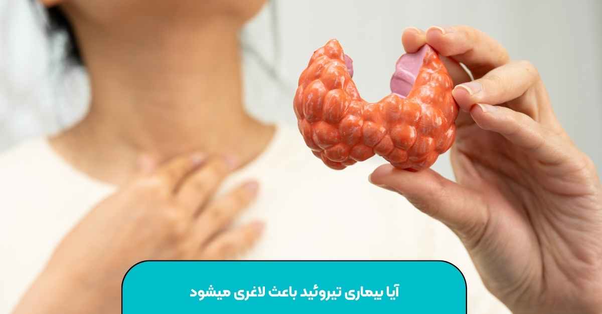 Does thyroid disease cause weight loss? The most scientific explanation [Dr. Shams]