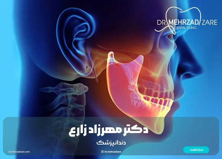 What are the symptoms of a broken jaw?