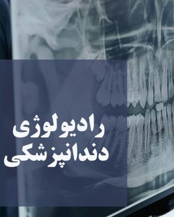 رادیولوژی دندان ونک توانیر