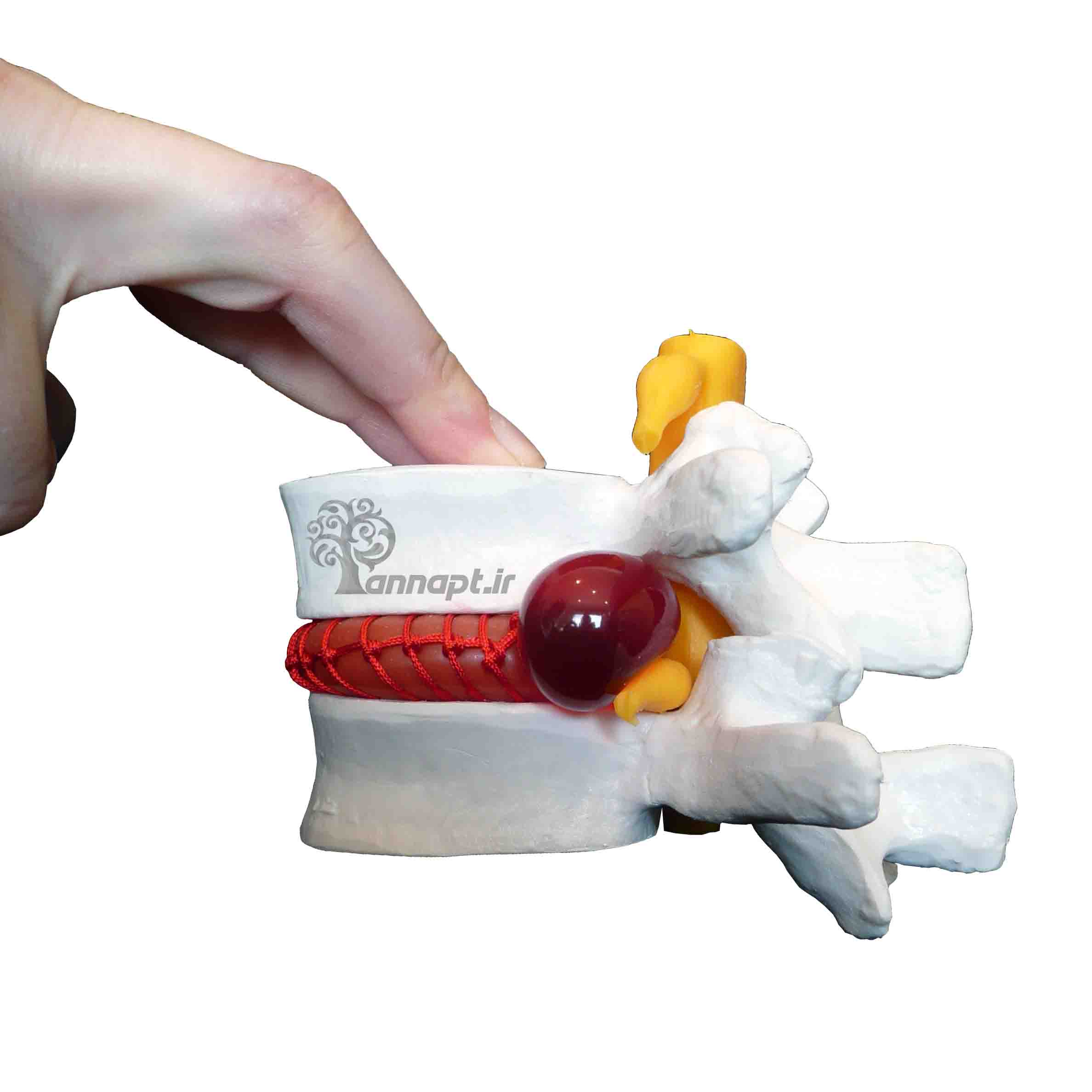 كل ما تريد معرفته عن القرص القطني وتشخيصه وطرق علاجه!