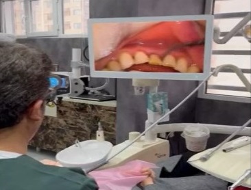 میکروسکوپ سه بعدی دندانی دکتر جمال سلطانی جراح، دندانپزشک و متخصص ایمپلنت در تبریز