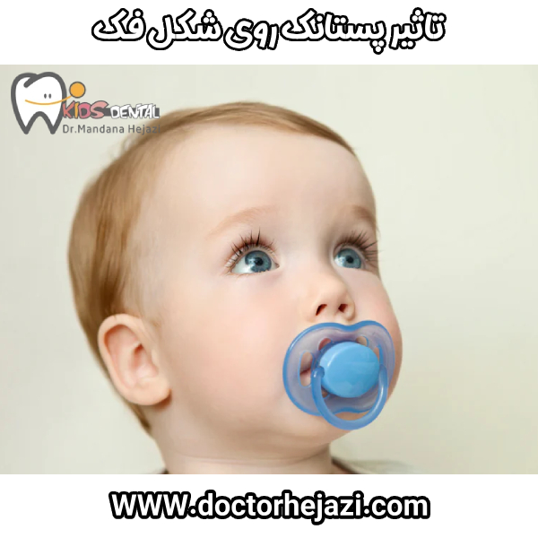 The effect of the pacifier on the shape of the jaw Dr. Mandana Hejazi