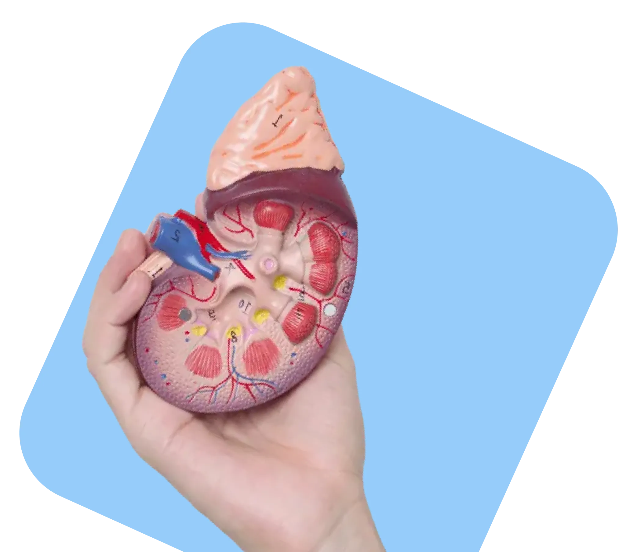 Plasmapheresis: treatment of autoimmune diseases to cancer with plasmapheresis Dr. Kihani Fard