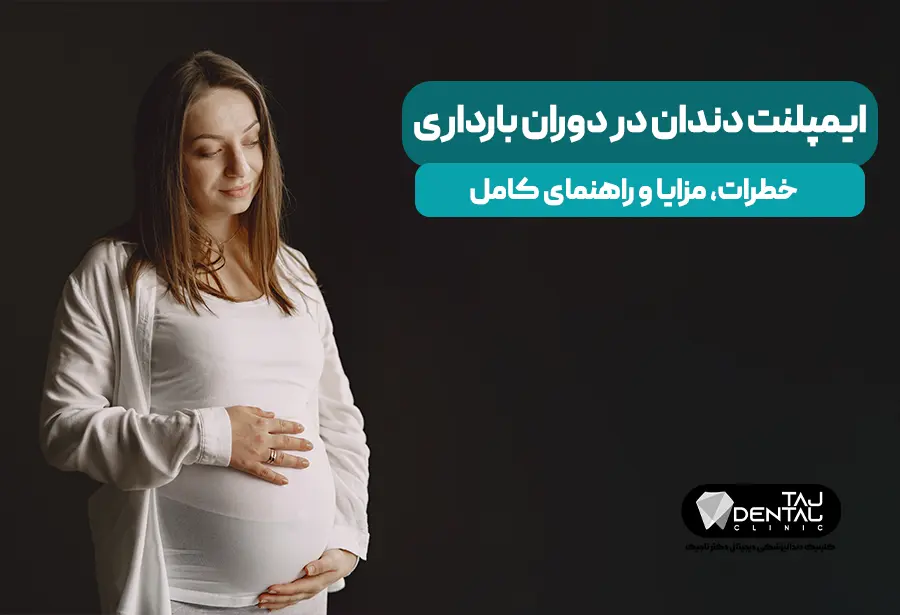 Dental implant during pregnancy Risks, benefits and complete guide