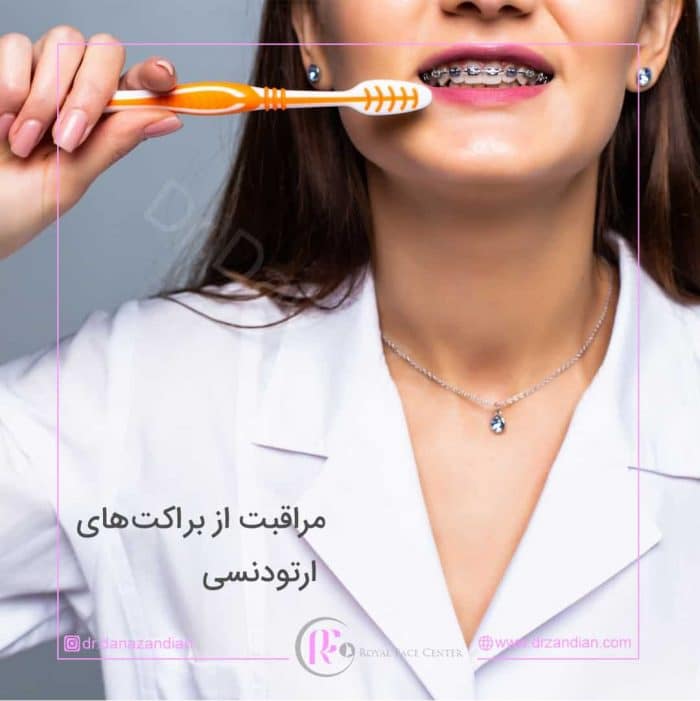 Orthodontic hygiene: oral and dental care during orthodontic treatment