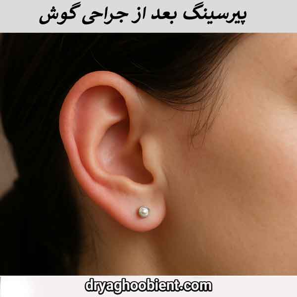 Is ear piercing dangerous after otoplasty surgery? Complete guide