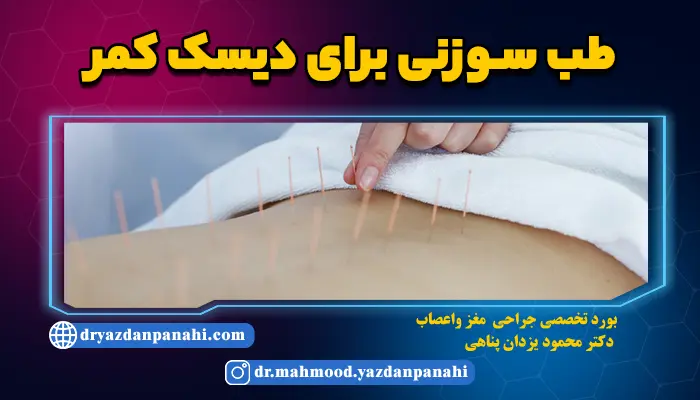 Acupuncture for lumbar disc | Acupuncture side effects for lumbar disc + cost