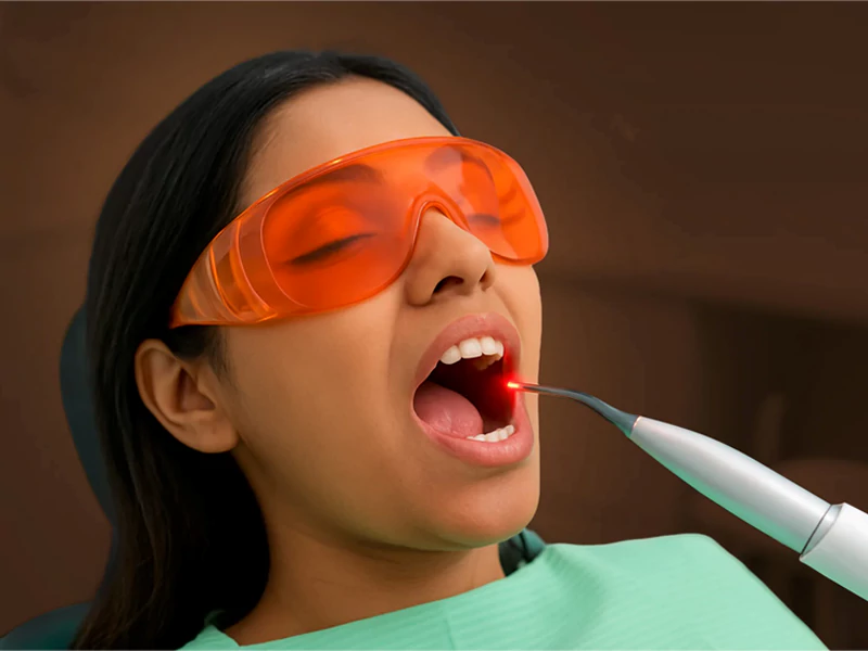 عصب کشی دندان با لیزر در کرج – معرفی روشی جدید