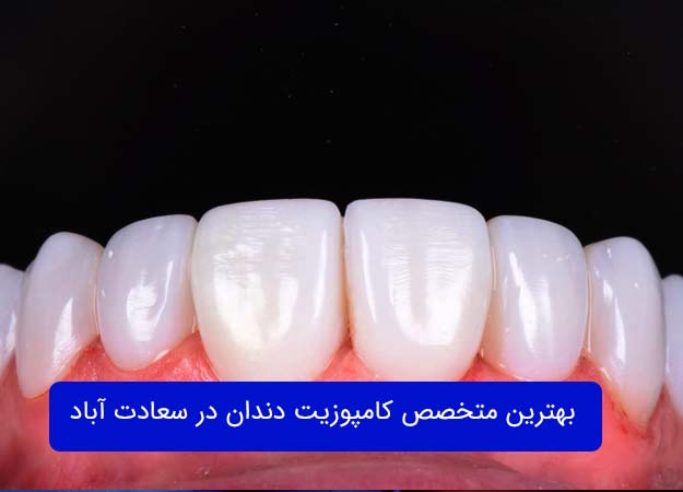 تركيب الأسنان في سعدات آباد