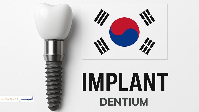 Dentium implant (Korean) with 98% success Price, benefits, complications