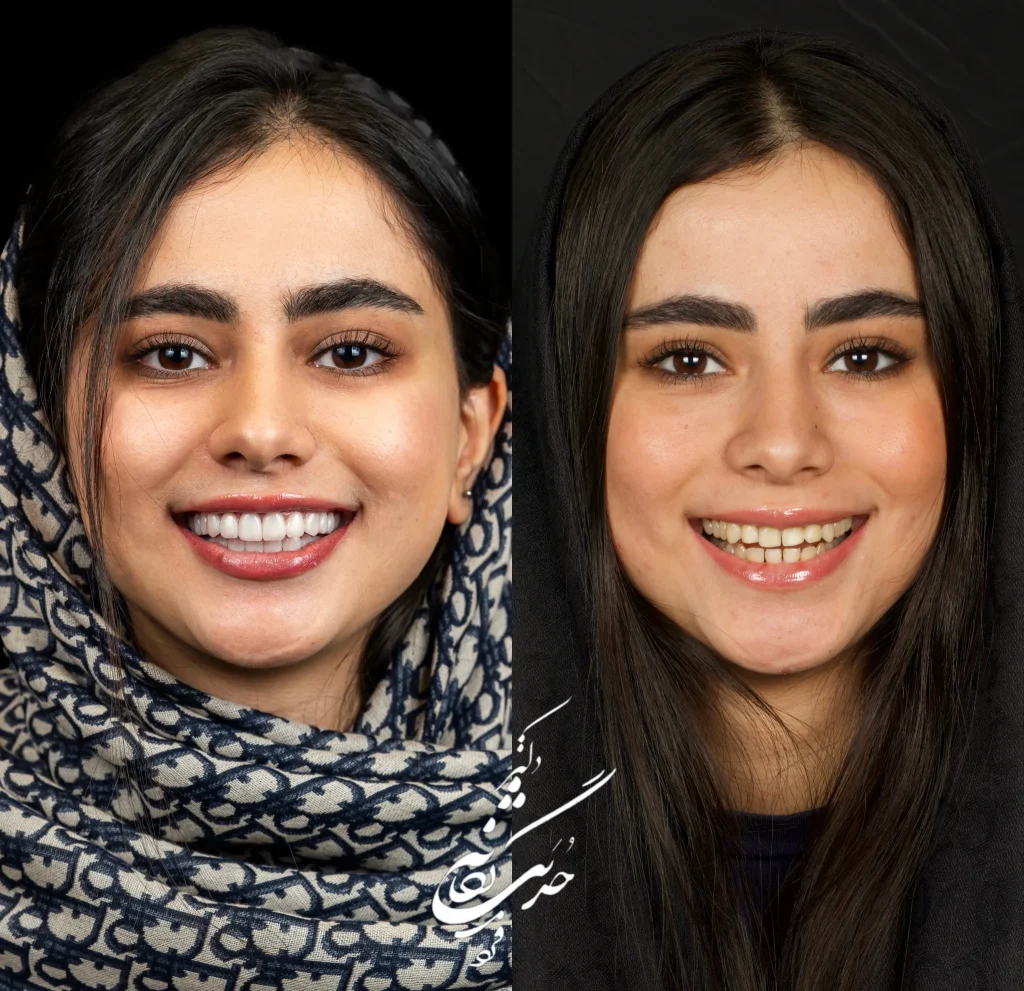 بهترین متخصص کامپوزیت دندان در پاسداران تهران 1404