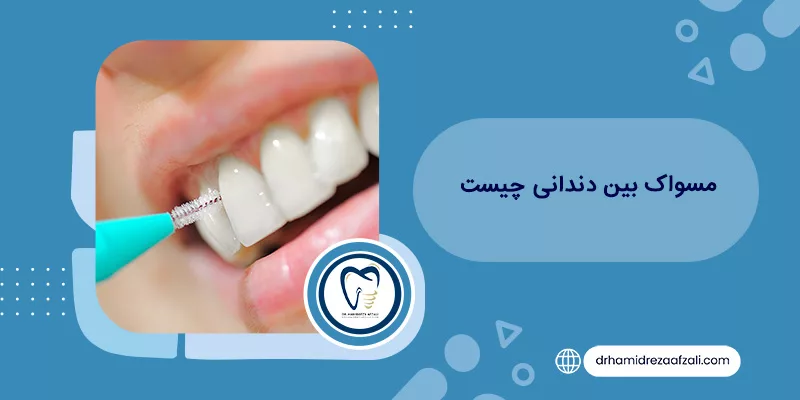 ما هي فرشاة الأسنان بين الأسنان؟ التعرف على التطبيقات | دكتور حميدرضا أفضلي