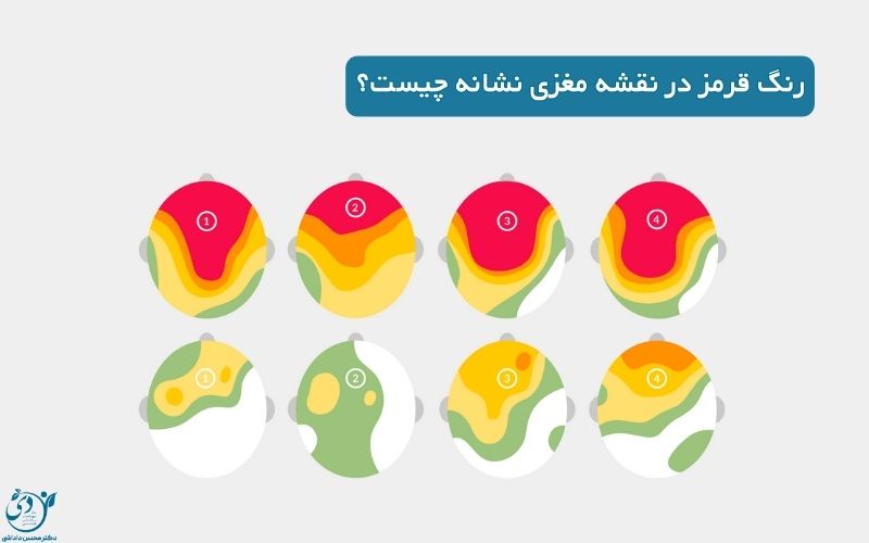 رنگ قرمز در نقشه مغز چیست؟ پشت پرده فعالیت های عصبی