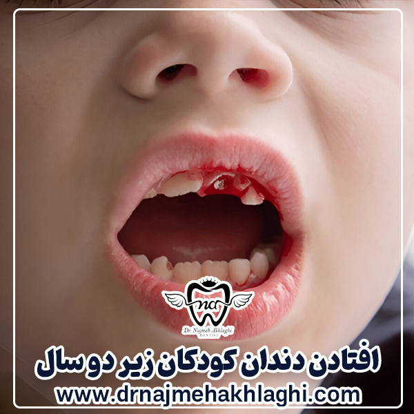Causes of teeth falling out in children under two years of age - Dr. Najmeh Ehalli