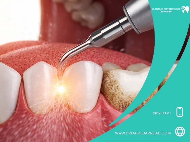 Misbeliefs about the damaging of tooth enamel | Dr