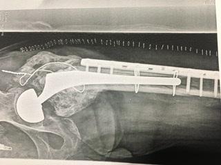 Trauma and fracture surgery Dr. Kamrani Rad