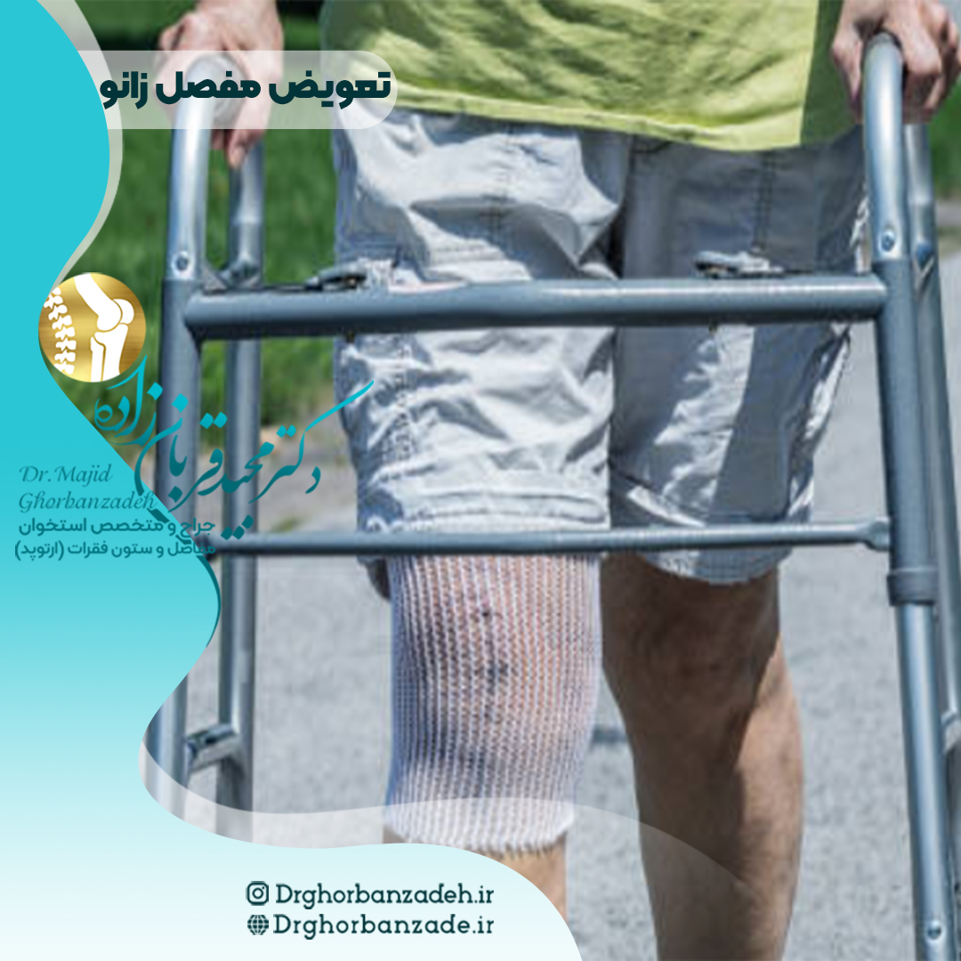 تعویض زانو در سالمندان - خطرات جراحی در سالمندان