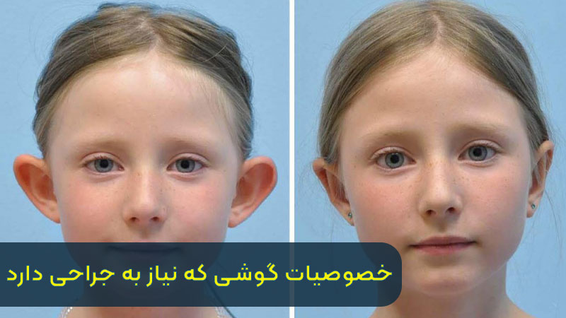ویژگی های گوشی که نیاز به جراحی دارد