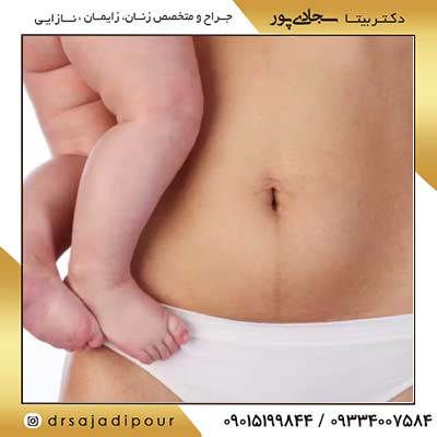 افتادگی رحم: علائم، تشخیص و روش های درمان