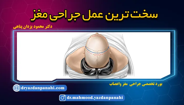 The most difficult brain surgery Complications + types of brain surgeries