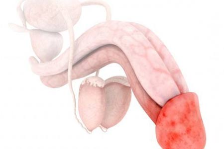 Treatment of a red spot on the cap of the genital organ