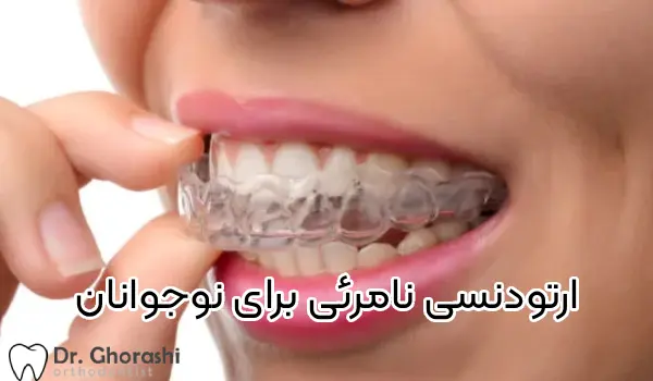 ارتودنسی نامرئی نوجوانان معرفی بهترین متخصص