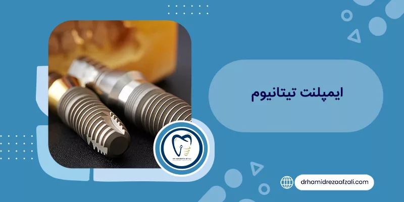 ما هي زراعة التيتانيوم؟ مراجعة أسعار زراعة التيتانيوم - دكتور أفضلي