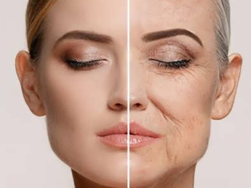 بهترین جراح لیفت صورت در اصفهان + نمونه کار