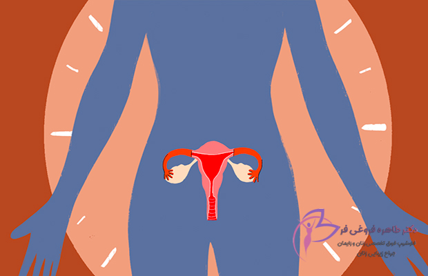 یائسگی زودرس چیست و چگونه از آن پیشگیری کنیم؟ - دکتر طاهره فروغی فر