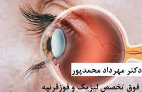 دور الذكاء الاصطناعي في تشخيص القرنية المخروطية - د. مهرداد محمد بور