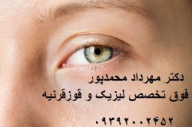 4 افسانه رایج در مورد چشم پزشکی - دکتر مهرداد محمدپور