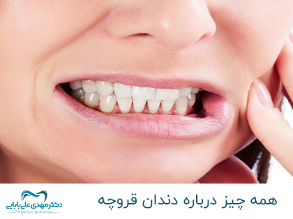 كل شيء عن طحن الأسنان - د. مهدي علي بابائي