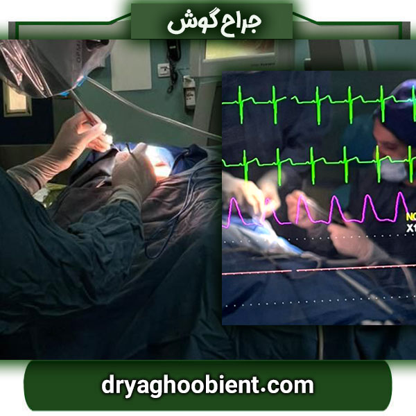 Ear surgeon in Tehran + the most experienced ear specialist, Dr. Maryam Yaqoubi