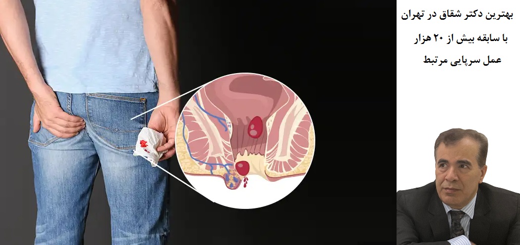 بهترین دکتر شقاق در تهران