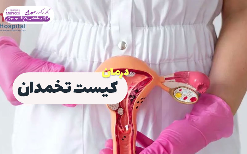 کیست تخمدان چیست؟ دکتر نرگس محرابی